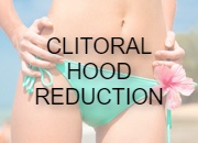 Clitoral Hood Reduction