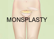 Monsplasty India