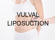 Vulval Liposuction